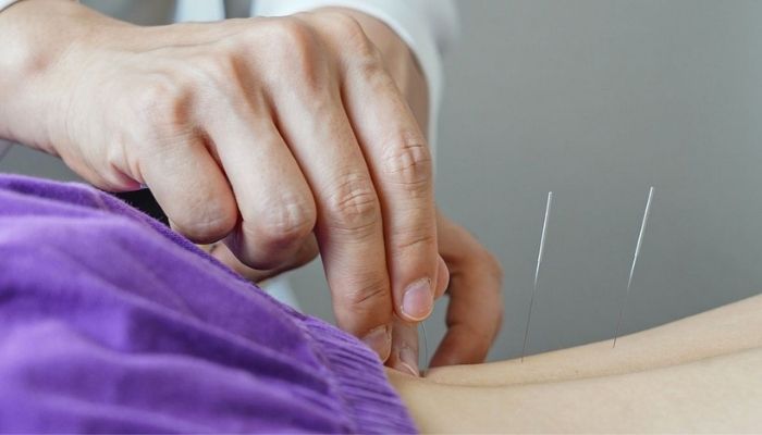  Brasil regulamenta exercício profissional da acupuntura 